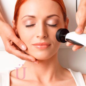 RADIOFRECUENCIA FACIAL
